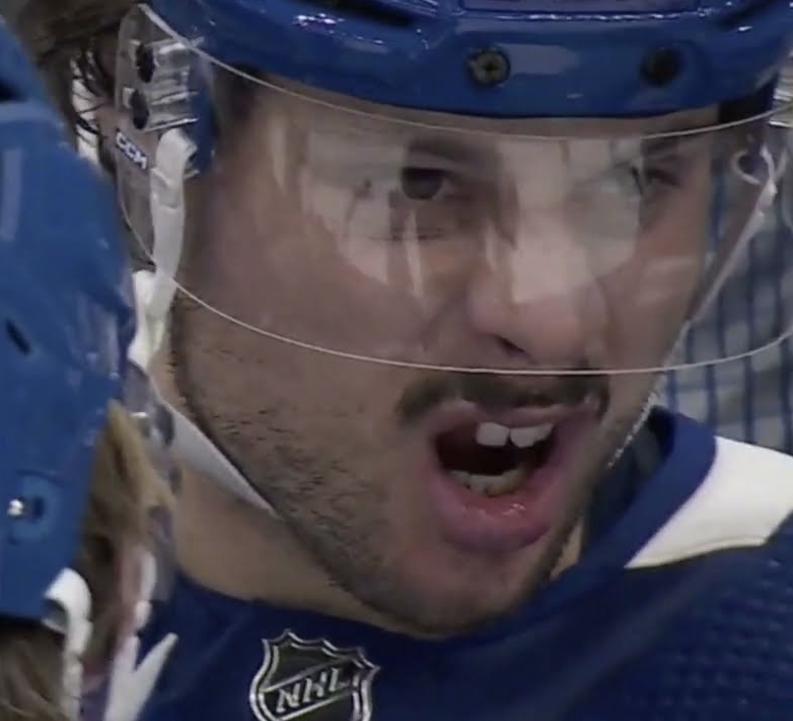 Pictures Of NHL Players Who Lost A Tooth